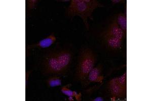 Immunofluorescence staining of methanol-fixed Hela cells using JunB(Phospho-Ser79) Antibody. (JunB anticorps  (pSer79))