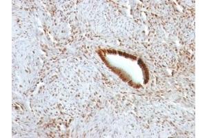 Formalin-fixed, paraffin-embedded human uterus stained with Nucleolin antibody. (Nucleolin anticorps)