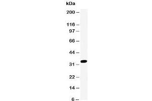 Western blot testing of Cdk2 antibody and Jurkat lysate