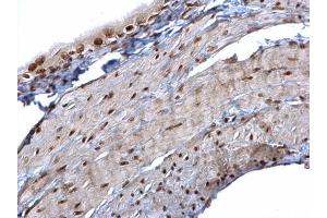 IHC-P Image hnRNP K antibody detects hnRNP K protein at nucleus on mouse urinary bladder by immunohistochemical analysis.