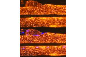 Immunofluorescence analysis of Rat skeletal muscle using Calsequestrin 1 antibody (ABIN7266045) at dilution of 1:100. (Calsequestrin anticorps)