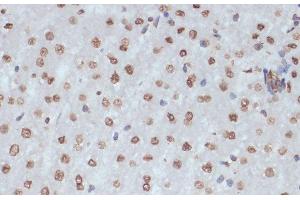 Immunohistochemistry of paraffin-embedded Rat liver using Phospho-CDK1(Y15) Polyclonal Antibody at dilution of 1:100 (40x lens). (CDK1 anticorps  (pTyr15))