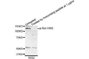 Western blot analysis of extracts of K562 cells, using Phospho-Ret-Y905 antibody.