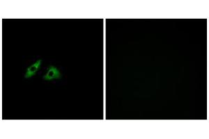 Immunofluorescence analysis of HeLa cells, using GPR152 antibody. (GPR152 anticorps  (Internal Region))