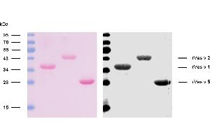 Reactivity of rVes v 1, rVes v 2, and rVes v 5 with sIgE antibodies in plasma a patient with confirmed presence (routine clinical test) of specific IgE antibodies to common wasp venom allergen extract.