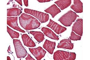 Anti-FZD3 / Frizzled 3 antibody IHC of human skeletal muscle.