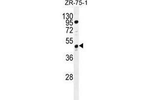 tcag7. (Tcag7.1071 (AA 417-438), (C-Term) anticorps)