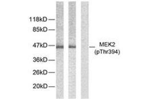 Western blot analysis of extracts from ovary cancer, using MEK2 (Phospho-Thr394) Antibody. (MEK2 anticorps  (AA 261-310))