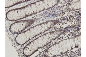 Image no. 1 for anti-Ribosomal Protein L14 (RPL14) (AA 1-91) antibody (ABIN465975)