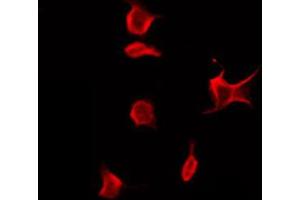 ABIN6272382 staining A549 by IF/ICC.