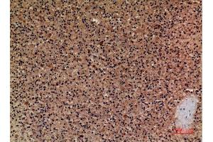 Immunohistochemistry (IHC) analysis of paraffin-embedded Human Spleen, antibody was diluted at 1:100.