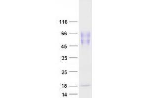 Validation with Western Blot