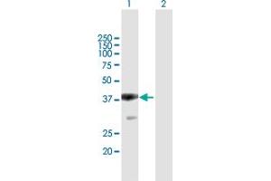 Western Blot analysis of PBRM1 expression in transfected 293T cell line by PBRM1 MaxPab polyclonal antibody. (Polybromo 1 anticorps  (AA 1-306))