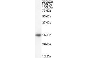 ABIN184699 staining (2µg/ml) of Human Adrenal Gland lysate (35µg protein in RIPA buffer).