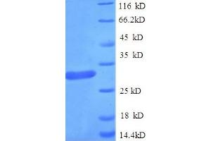 SDS-PAGE (SDS) image for Guanidinoacetate N-Methyltransferase (GAMT) (AA 1-236), (full length) protein (His tag) (ABIN5709557)