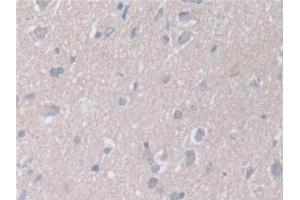 Detection of RARa in Human Cerebrum Tissue using Polyclonal Antibody to Retinoic Acid Receptor Alpha (RARa)