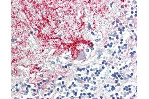 Anti-DAB1 antibody IHC staining of human brain, cerebellum. (DAB1 anticorps  (AA 189-216))