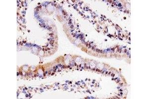 IHC testing of paraffin-embedded rat small intestine using Cdk4 antibody at 1:25.