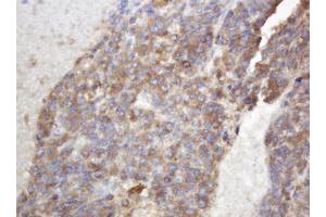 Image no. 6 for anti-TAP Binding Protein-Like (TAPBPL) antibody (ABIN1501302)