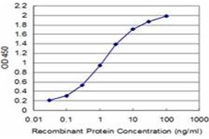 anti-Synovial Sarcoma, X Breakpoint 2 (SSX2) (AA 1-223) antibody