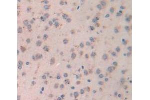 Figure. (LGALS7 anticorps  (AA 2-136))