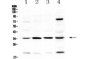 Western blot analysis of STUB1 using anti-STUB1 antibody . (STUB1 anticorps  (AA 51-303))