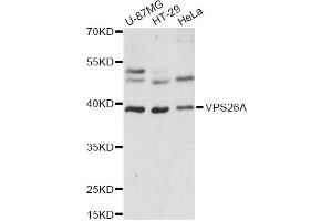 Western blot analysis of extracts of various cell lines, using VPS26A antibody (ABIN6292339) at 1:1000 dilution. (VPS26A anticorps)