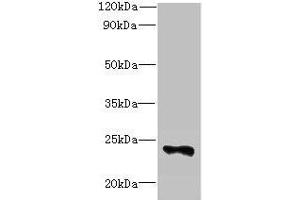Western blot All lanes: FAM156A antibody at 5 μg/mL + Mouse heart tissue Secondary Goat polyclonal to rabbit IgG at 1/10000 dilution Predicted band size: 25 kDa Observed band size: 25 kDa (FAM156A anticorps  (AA 1-153))
