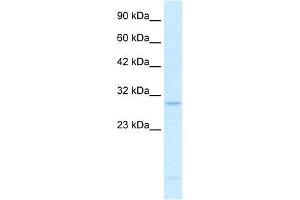 WB Suggested Anti-RALY Antibody Titration:  0. (Raly anticorps  (N-Term))
