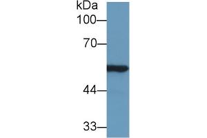 Western blot analysis of Rat Kidney lysate, using Mouse ALDH7A1 Antibody (1 µg/ml) and HRP-conjugated Goat Anti-Rabbit antibody ( (ALDH7A1 anticorps  (AA 29-539))