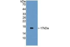 Detection of Recombinant iNV, Rat using Polyclonal Antibody to Involucrin (INV)