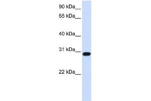 WB Suggested Anti-FOXR1 Antibody Titration:  0. (FOXR1 anticorps  (N-Term))