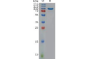 Human NO Protein, His Tag on SDS-PAGE under reducing condition.