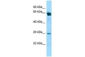 Host:  Rabbit  Target Name:  Racgap1  Sample Type:  Rat Stomach lysates  Antibody Dilution:  1. (RACGAP1 anticorps  (C-Term))