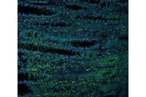 anti-NAD Dependent Malate Dehydrogenase (NAD-ME) (AA 26-584) antibody