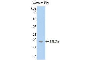 Western Blotting (WB) image for anti-Plexin B1 (PLXNB1) (AA 200-727) antibody (ABIN1860270) (PLXNB1 anticorps  (AA 200-727))