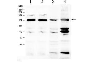 Western blot analysis of NCKAP1 using anti- NCKAP1 antibody . (NCKAP1 anticorps  (AA 2-201))