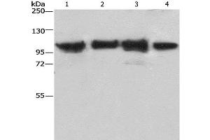 Western Blot analysis of Lovo cell and Mouse kidney tissue, 231 and hepG2 cell using ACTN4 Polyclonal Antibody at dilution of 1:485 (alpha Actinin 4 anticorps)