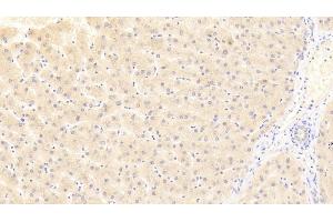 Detection of DKK4 in Human Liver Tissue using Polyclonal Antibody to Dickkopf Related Protein 4 (DKK4)