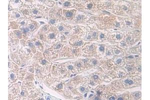 Detection of IL7R in Human Liver Tissue using Polyclonal Antibody to Interleukin 7 Receptor (IL7R) (IL7R anticorps  (AA 173-260))