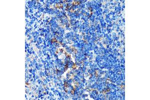 Immunohistochemistry of paraffin-embedded Rat spleen using GMIP Rabbit pAb (ABIN7267369) at dilution of 1:100 (40x lens). (GMIP anticorps  (AA 1-91))