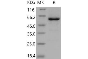 Western Blotting (WB) image for 5'-Nucleotidase, Ecto (CD73) (NT5E) (Active) protein (His tag) (ABIN7194079) (CD73 Protein (His tag))