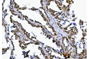 IHC analysis of SPT5/SUPT5H using anti-SPT5/SUPT5H antibody (ABIN7601985). (SUPT5H anticorps  (AA 533-1087))