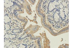 Immunohistochemical staining of rat colon using anti-syntaxin antibody ABIN7072248 Formalin fixed rat colon slices were were stained with ABIN7072248 at 3 μg/mL. (Recombinant Syntaxin anticorps)