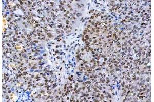 IHC analysis of HnRNP H/HNRNPH1 using anti-HnRNP H/HNRNPH1 antibody (ABIN4886623). (HNRNPH1 anticorps  (N-Term))