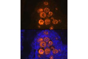Immunofluorescence analysis of rat bone marrow using CXCL4/CXCL4/PF4 Rabbit mAb (ABIN1683188, ABIN3017983, ABIN3017984 and ABIN7101555) at dilution of 1:100 (40x lens). (PF4 anticorps)