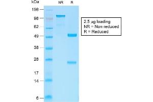 SDS-PAGE Analysis Purified Beta-Catenin Recombinant Rabbit Monoclonal Ab (CTNNB1/2030R).