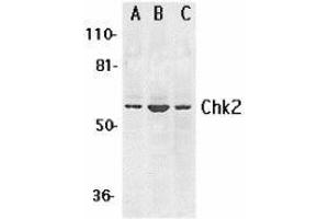 Western blot analysis of Chk2 expression in K562 (A), Jurkat (B), and HL-60 (C) whole cell lysates with AP30226PU-N Chk2 antibody at 1 μg /ml. (CHEK2 anticorps  (N-Term))