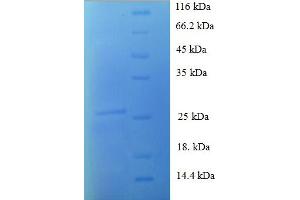 SDS-PAGE (SDS) image for S100 Calcium Binding Protein A1 (S100A1) (AA 2-94) protein (His-SUMO Tag) (ABIN4976038)