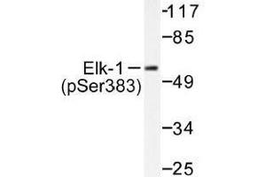 Image no. 1 for anti-ELK1, Member of ETS Oncogene Family (ELK1) (pSer383) antibody (ABIN318012) (ELK1 anticorps  (pSer383))